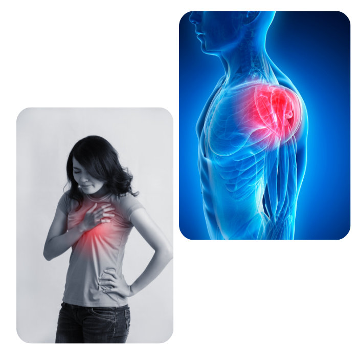 Shingles virus affecting nerve fibers in postherpetic neuralgia